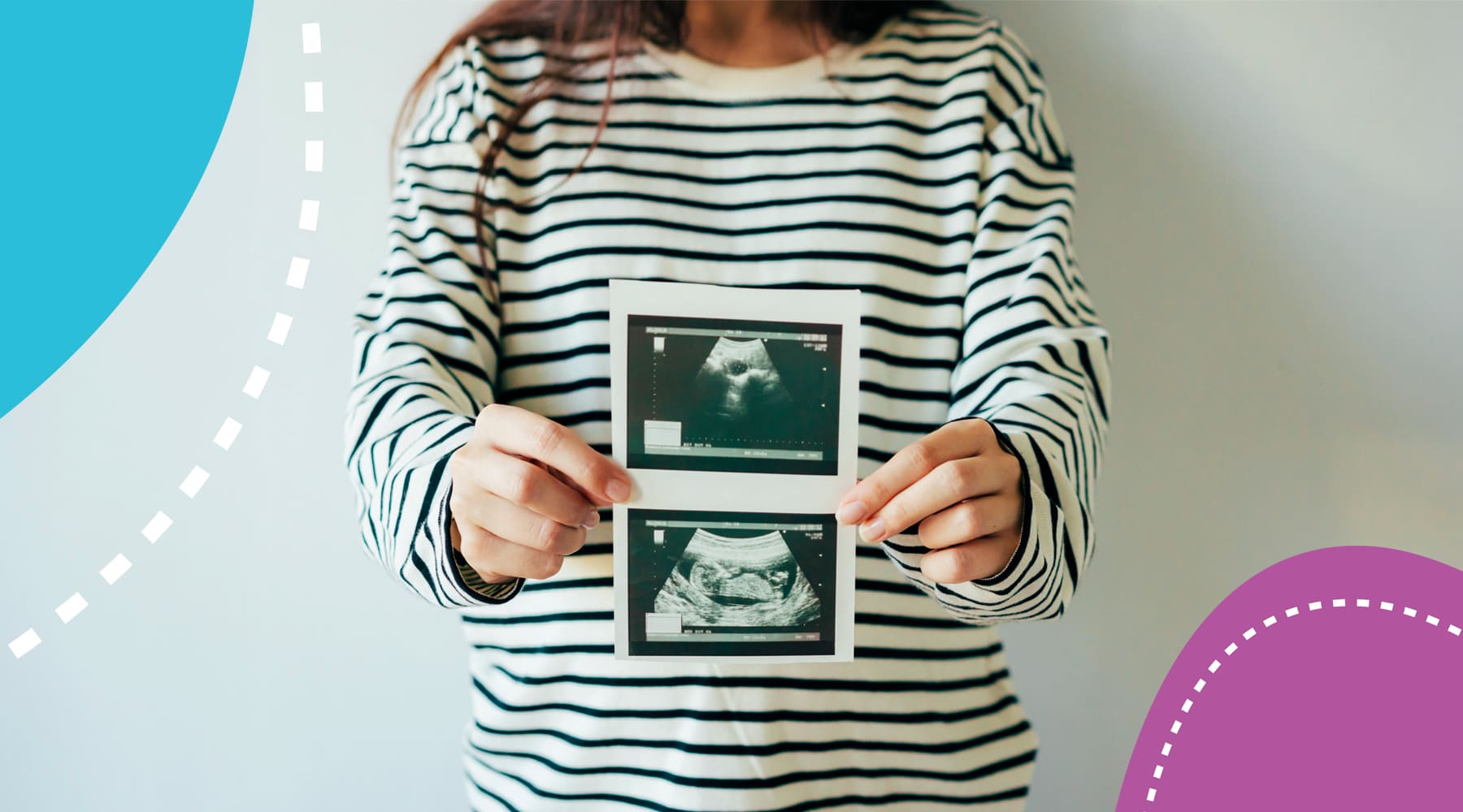 Me Siento diferente: cambios físicos desde la concepción hasta las 12 semanas de gestación